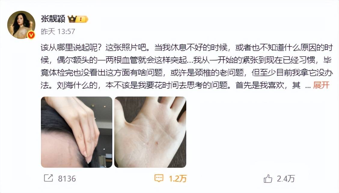 靓颖的遭遇给娱乐圈所有明星提了个醒OG视讯赚再多钱有什么用?歌后张(图3) 靓颖的遭遇给娱乐圈所有明星提了个醒OG视讯赚再多钱有什么用?歌后张(图3)